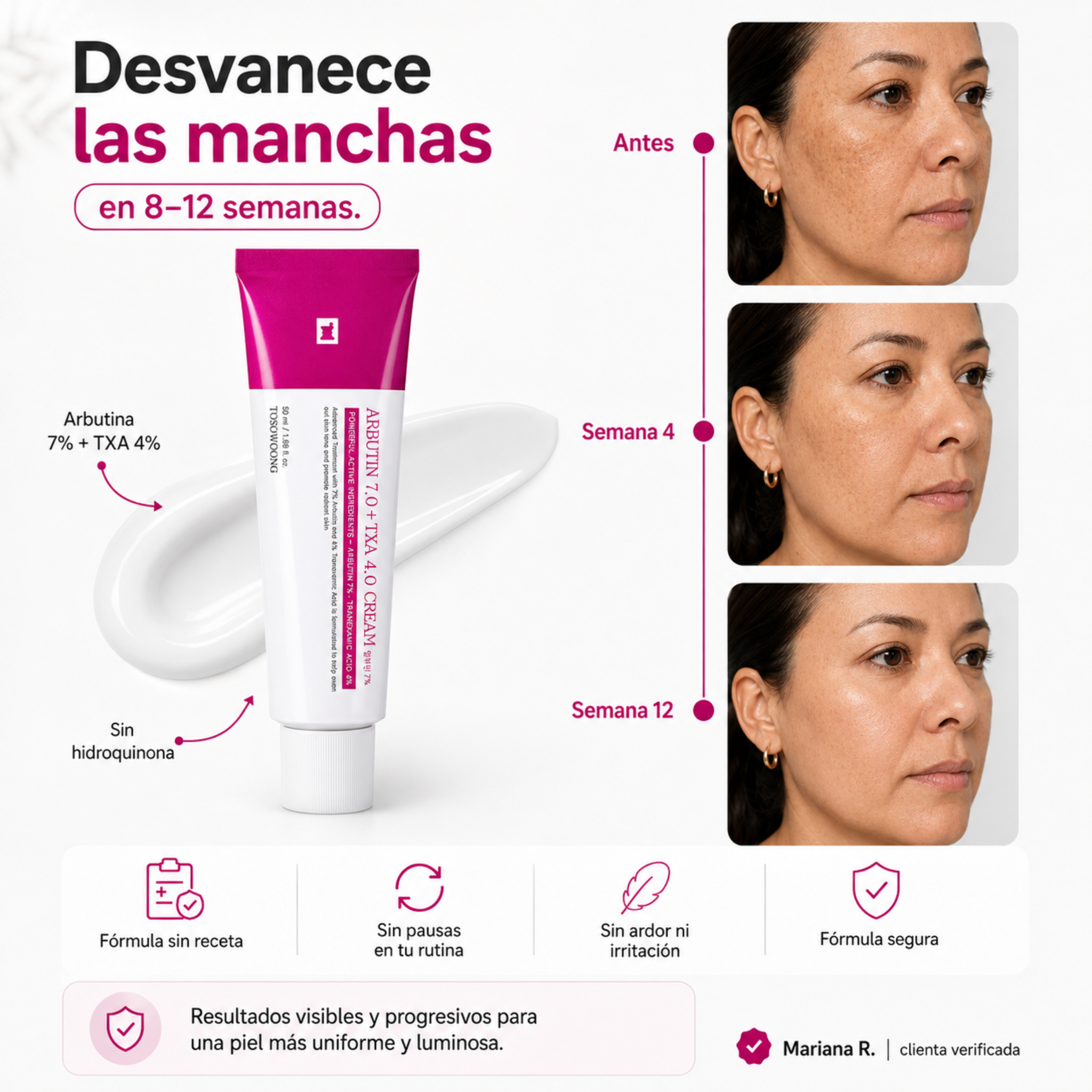 Crema Despigmentante para manchas con Arbutina y TXA