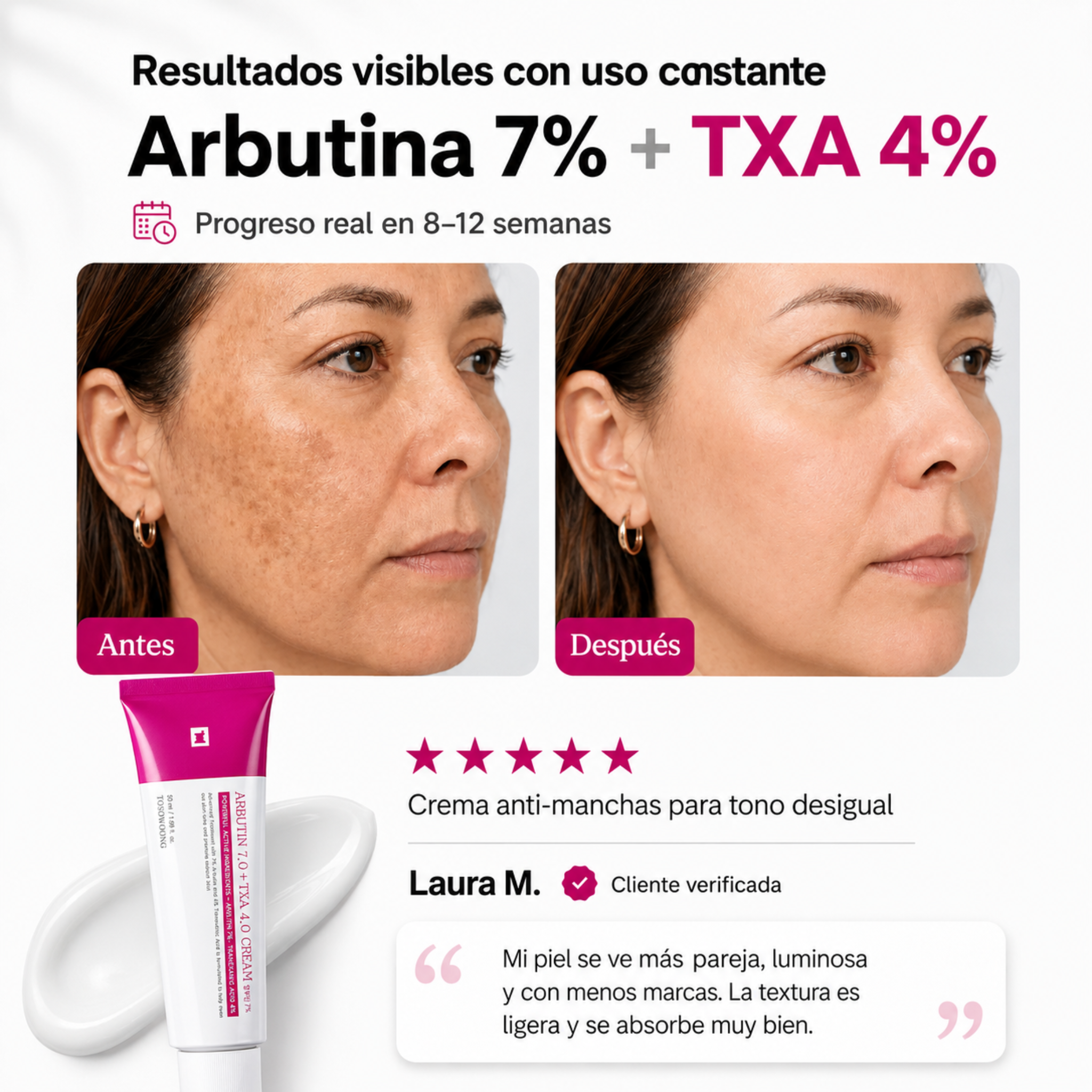Crema Despigmentante para manchas con Arbutina y TXA
